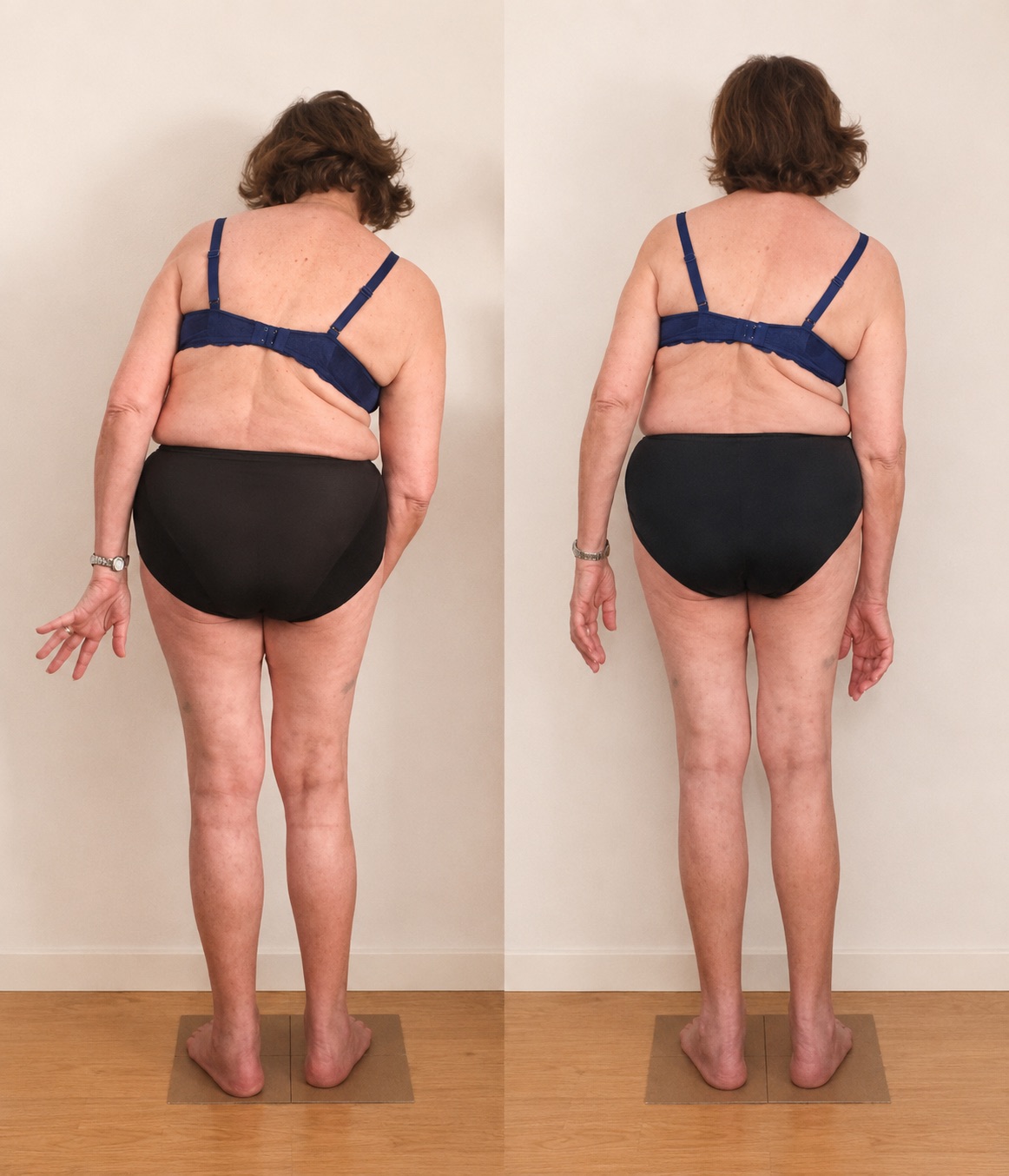 Conscious Alignment before/after – back view