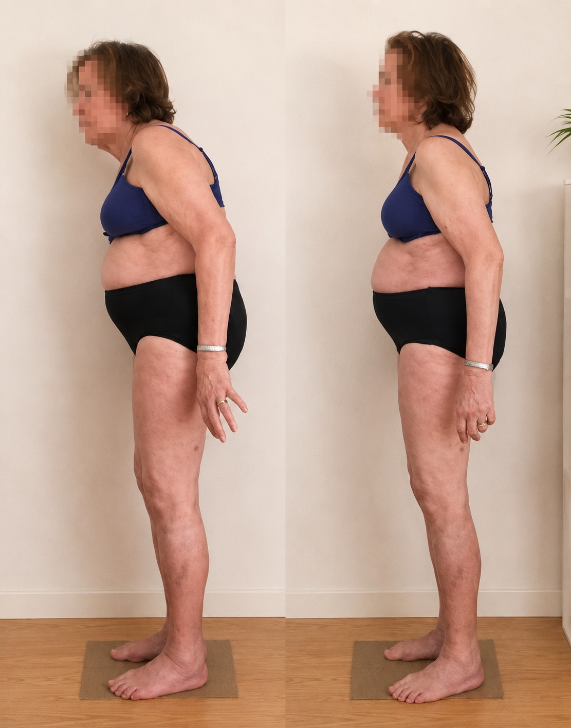 Conscious Alignment before/after – left view