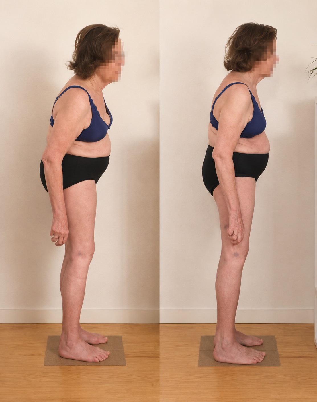 Conscious Alignment before/after – right view